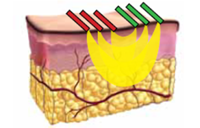 エンディメッドプロの3DEEPテクノロジー